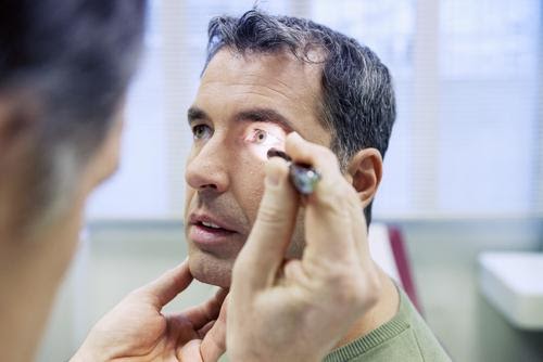 How to Prepare for Cataract Surgery: The 8-Step Guide | Silk Vision